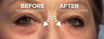 Be Flawless, In Just 2 Minutes! Amazing Video | Instantly Ageless | Anti Wrinkle Cream